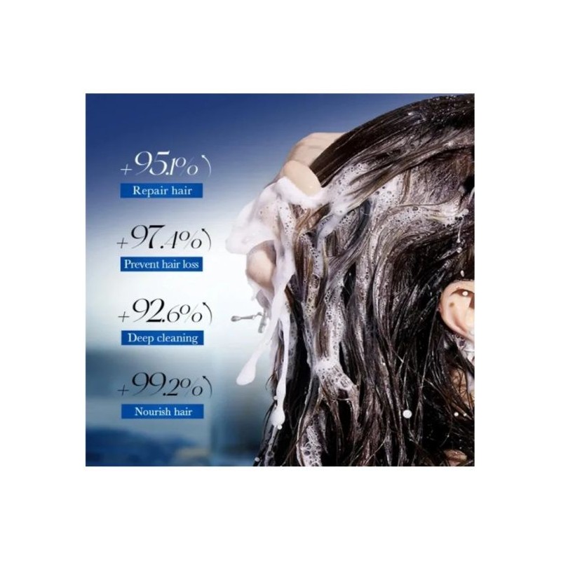 Шампунь для росту та зміцнення волосся Sadoer Minoxidil 300 ml
