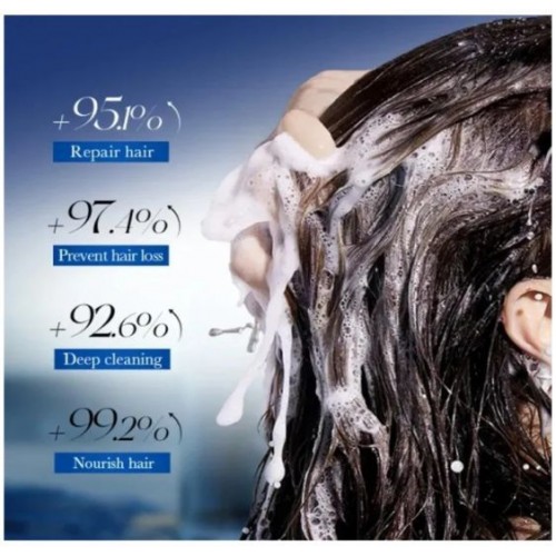 Шампунь для росту та зміцнення волосся Sadoer Minoxidil 300 ml